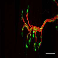 neuromuscular junction (NMJ)