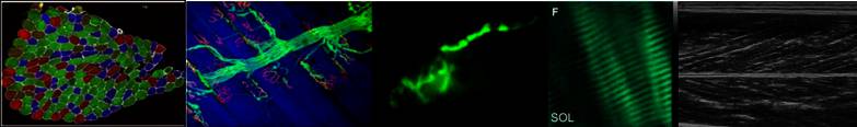 Muscle Contractility And Neuromuscular Plasticity