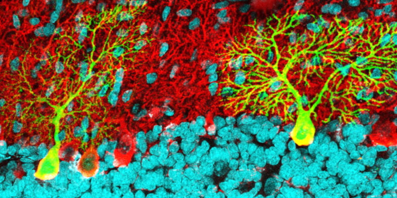 Enlightening Brain Mechanisms