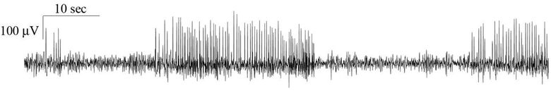 graph wave of plasticity in pathology